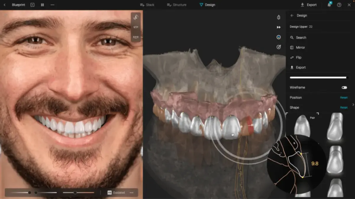 Anunț de angajare: Tehnician dentar, design digital