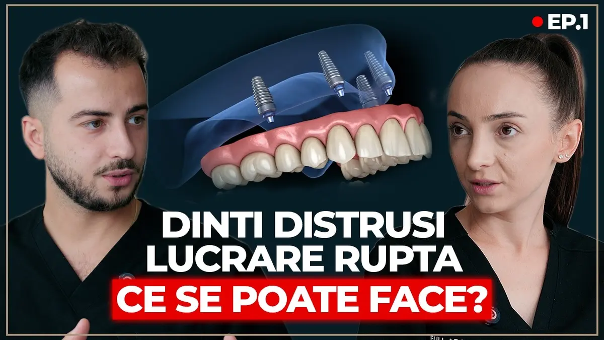 Ce se poate face atunci când lucrările vechi cedează: reabilitare completă pe implanturi