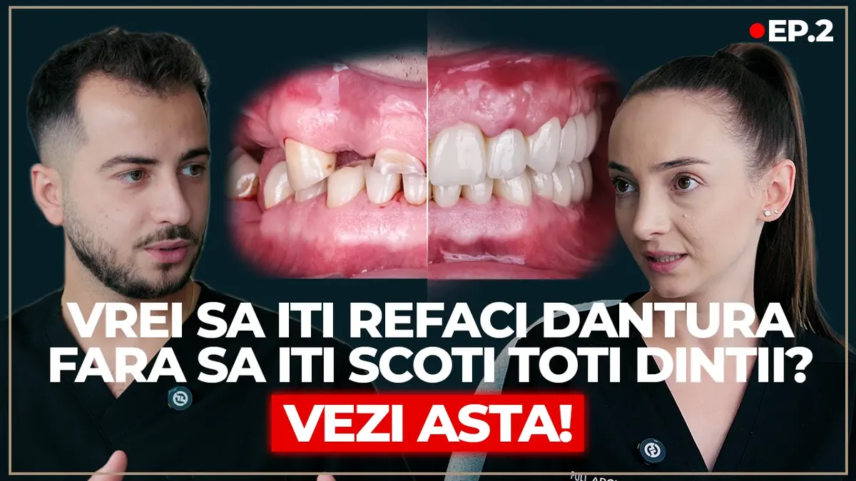 De ce nu i-am scos toți dinții: cazul domnului Dumitru, reabilitare mixtă pe dinți și implanturi