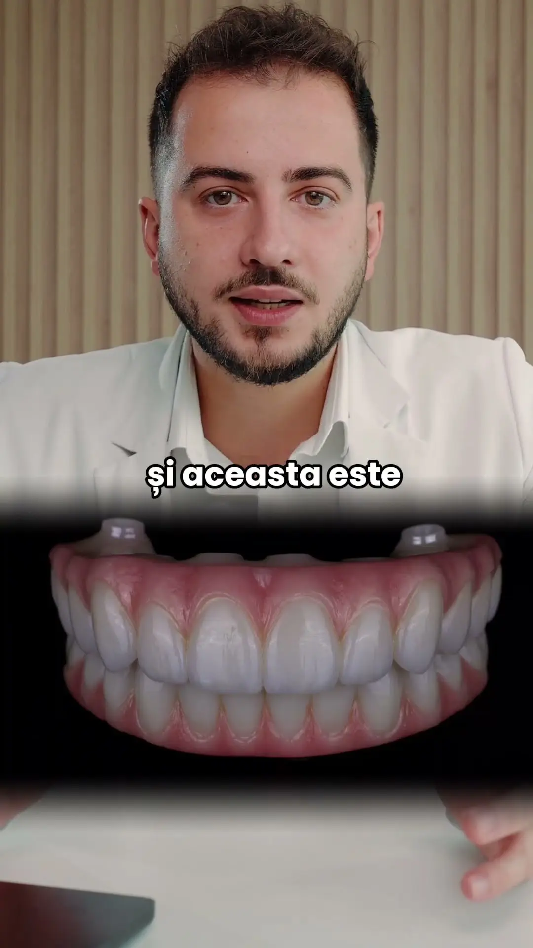 Dinți care se mișcă la atingere: ce înseamnă în boala parodontală avansată